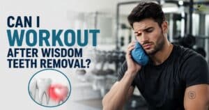 Can I Workout After Wisdom Teeth Removal?